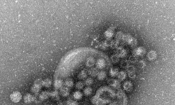 Norovirus