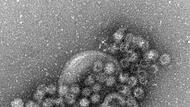 Norovirus